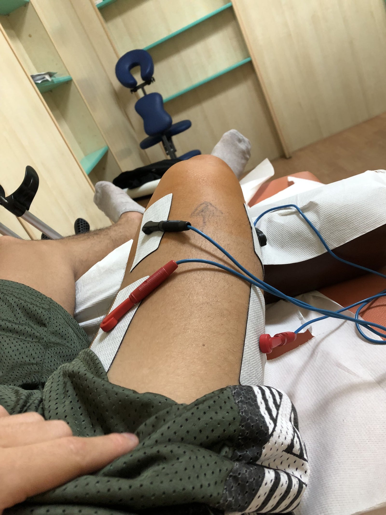 il protocollo "corretto" seguito alla lettera: 15 giorni di fisioterapia, e il ginocchio ancora fermo